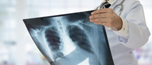 Рентгенология - профессиональная переподготовка